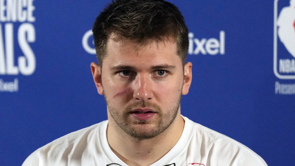 Luka Doncic on his Game 1 scar: ‘Makes me look tough’