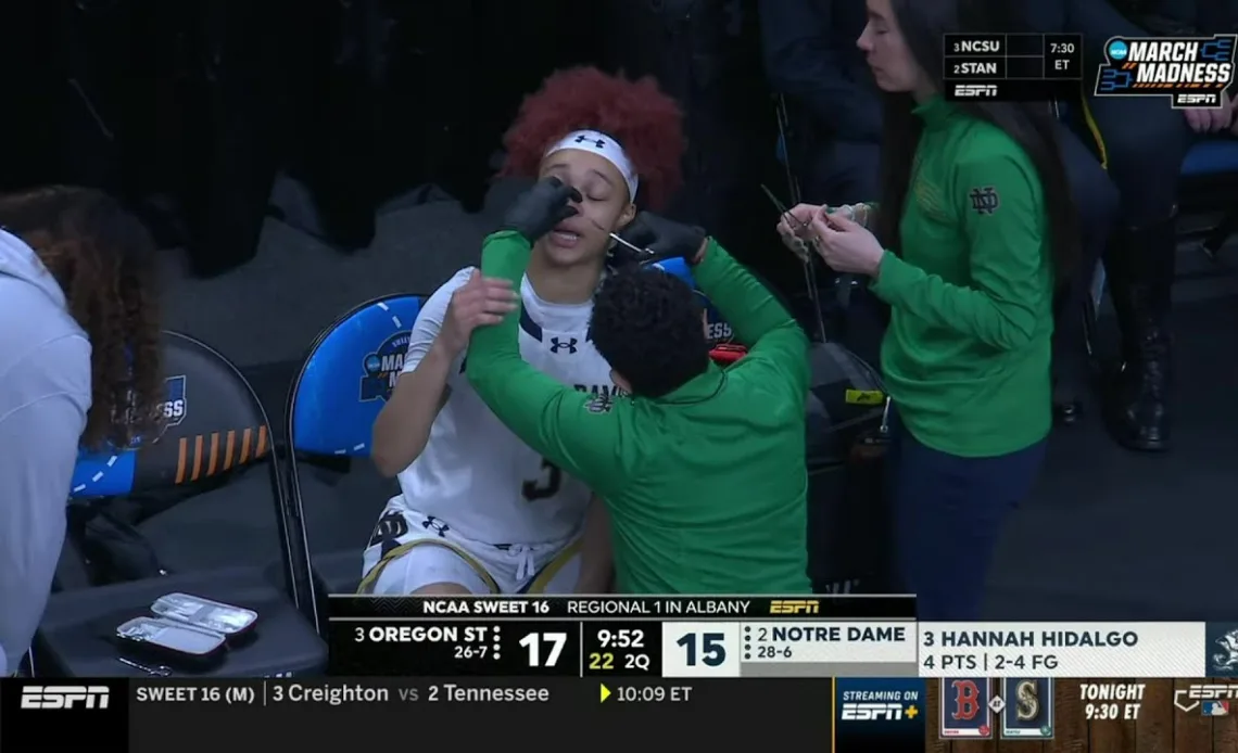 👀 Ref Makes Hannah Hidalgo Take Out Nose Stud | NCAA Tournament Sweet 16, Notre Dame vs Oregon State